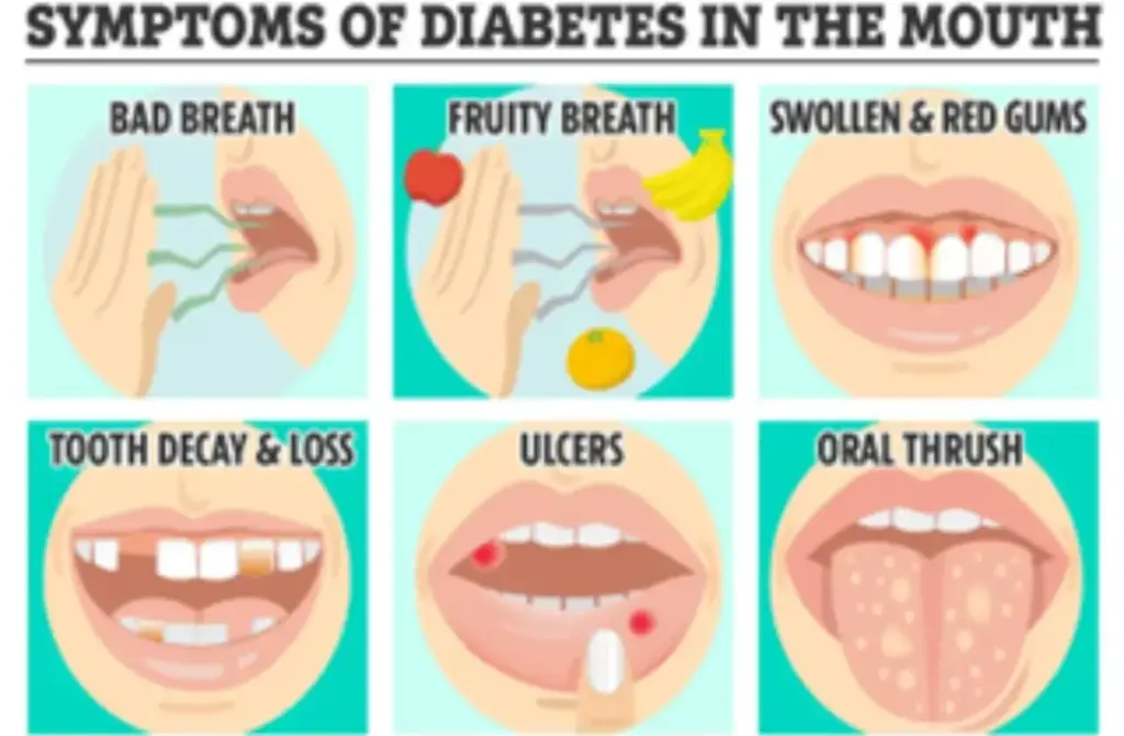 Diabetes and Dental Health: What You Should Know