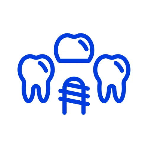 All on 4_ 6 Implants