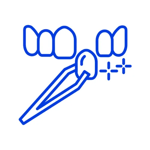 Cosmetic Dentistry - Veneers