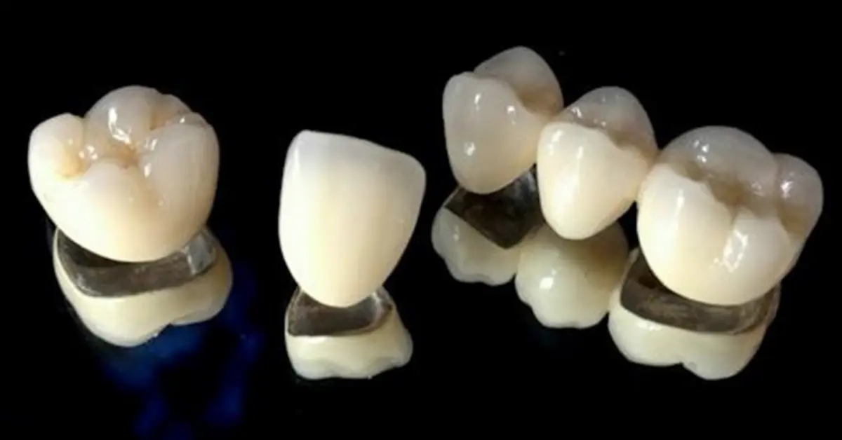 Ceramic crowns