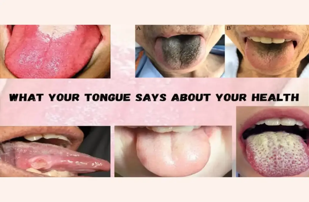 Chapter 27- What Your Tongue Says About Your Health