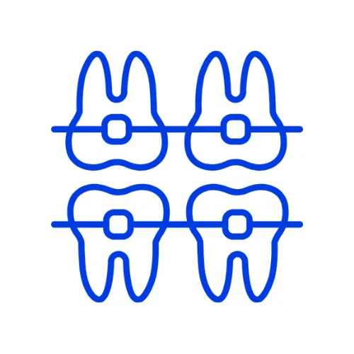 Orthodontics - Metal Brace