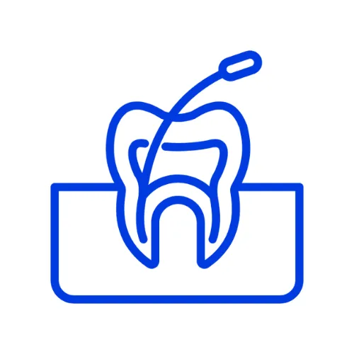 Root Canal Treatment