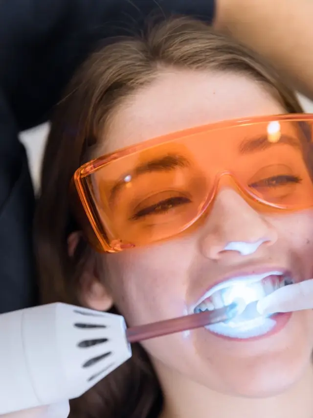 Teeth Whitening Methods
