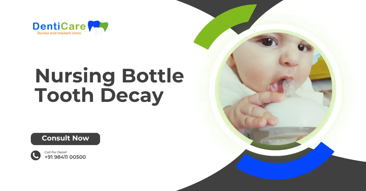 Chapter 10- Nursing bottle tooth decay