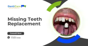 Chapter 16 - Missing Teeth Replacement