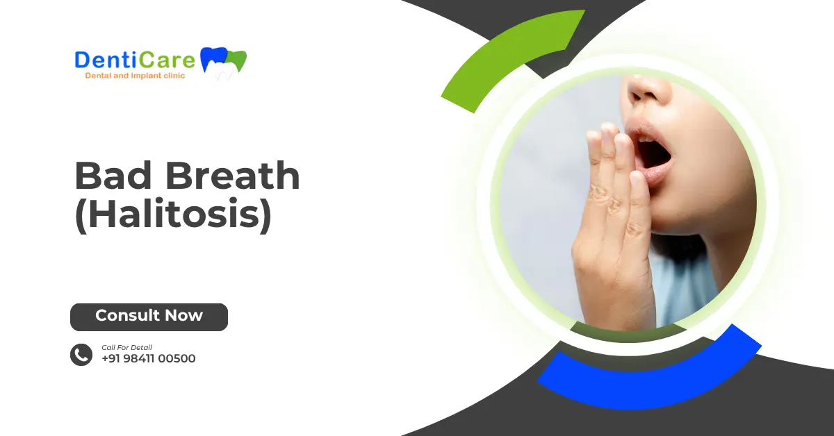 Chapter 19 - Bad Breath(Halitosis)