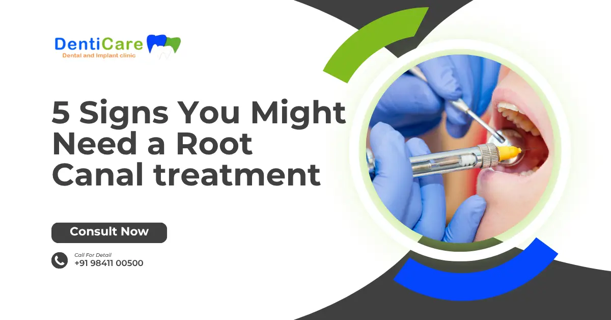 Chapter 28- 5 Signs You Might Need a Root Canal treatment— And When Not to Worry