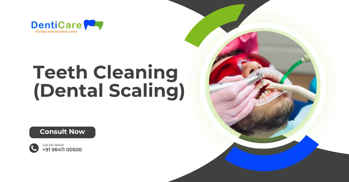 Chapter - 7 Teeth Cleaning (Dental Scaling)