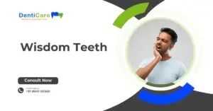 Chapter - 8 Wisdom Teeth